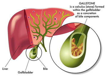 Gallbladder Flush - Five Things To Know - HerbalHermit USA